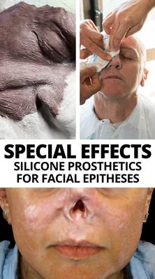 Silicone Prosthetics for Facial Epitheses